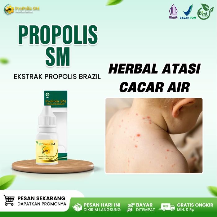 Propolis SM Obat Cacar Air Pada Anak, Campak, Pereda Demam, Pengering Luka Bekas Cacar