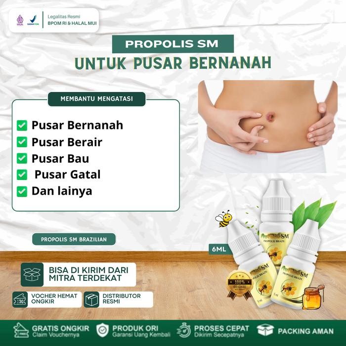 Propolis SM Solusi Utuk Mengatasi Pusar Bernanah, Pusar Berair Dan Berbau Tak Sedap, Pusar Gatal Dan