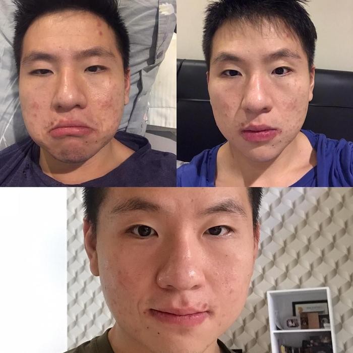 Dr. Schatz - Dr Schatz Mcc Sheet Mask - Masker Wajah - Missflolaks