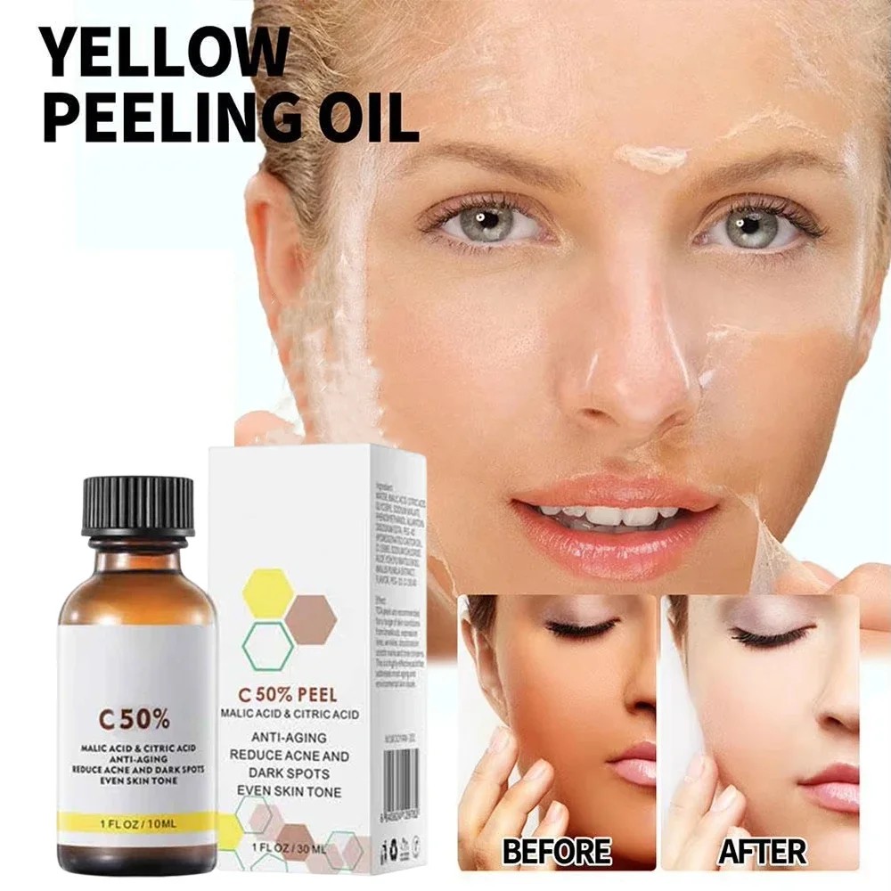 IMPORT High Quality 50% Chemical Peel Peel Acid Skin Superforce Peel Pigmentation Lightening Melanin