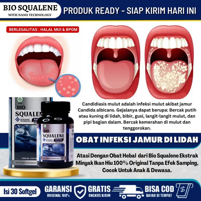 Obat Penghilang Lidah Putih Berjamur Lidah Pahit Jamur Kandidiasis