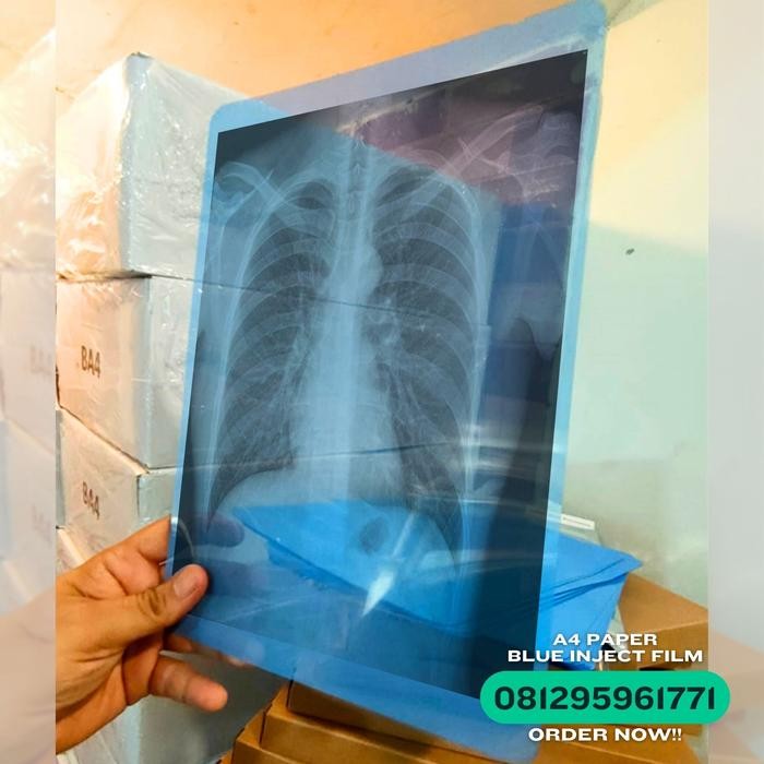 

Medical Film Radiology (Blue Inkjet Film), Ukuran A4, Kertas / Paper Xray