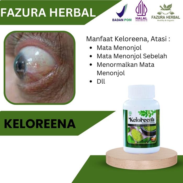 Keloreena - Suplemen Atasi Mata Menonjol Menormalkan Mata Menonjol Akibat Hipertiroid Atasi Mata
