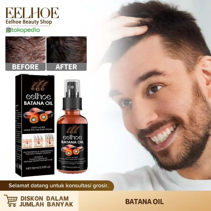 Eelhoe Batana Oil Hair Growth Spray Hair Nourishing Essential Oil Anti Hair Loss Spray Hair Growth