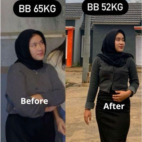 

Anti gendot top cerr perangkat kecantikan