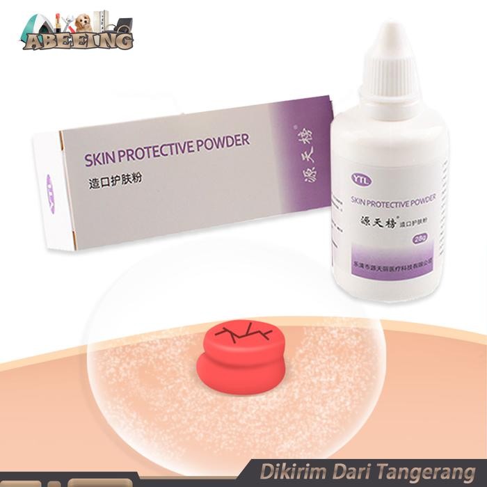 

Powder Kolostomi 28g Stoma Powder Ruam Dan Iritasi Kulit Kolostomi