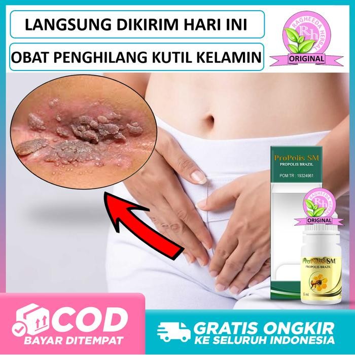 

Penghilang Kutil Kelamin Jengger Ayam - Kondiloma, HPV Herbal Shopee Terlaris