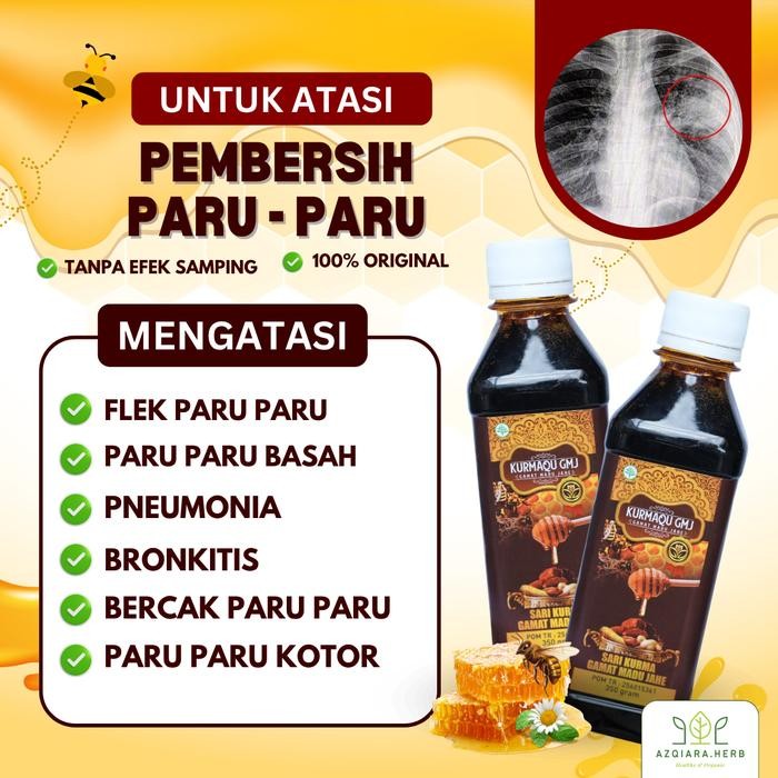 

Sale Kurmaqu Gmj - Atasi Flek Paru Paru, Tbc, Bronkitis, Pneumonia, Tbc Paru, Paru - Paru Basah,