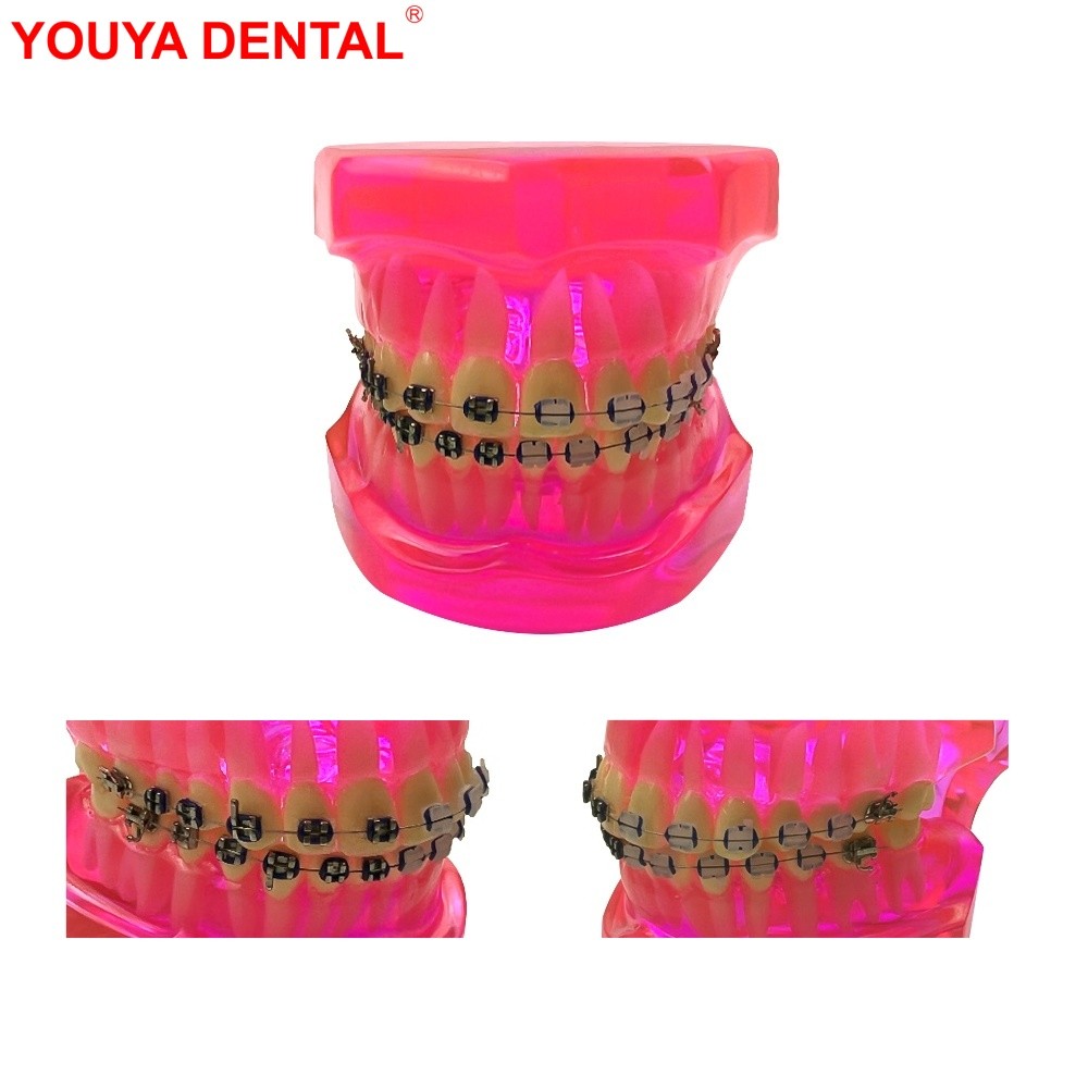 Dentistry Orthodontic Model Typodont Half Metal Half Ceramic Ortho Dental Teeth Model For Studying T