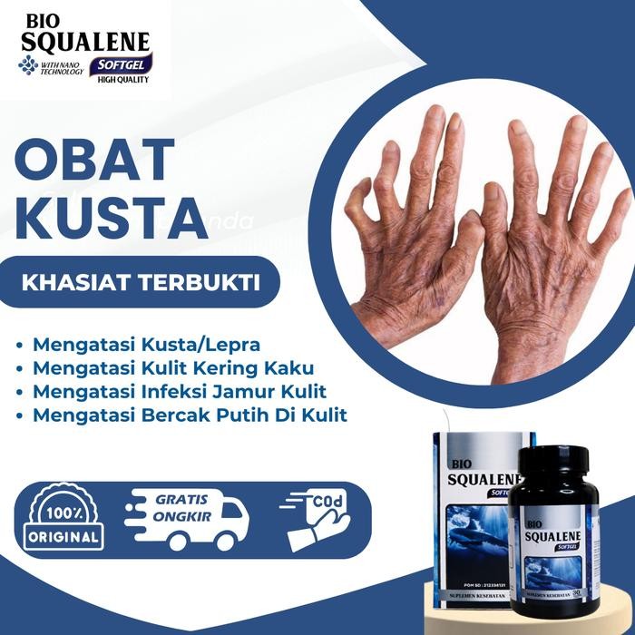 Bio Squalene Suplemen Untuk Penyakit Kusta /Lepra, Infeksi Jamur Kulit, Bercak Putih Di Kulit 30