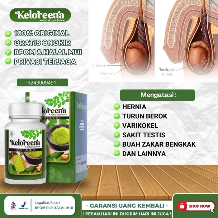 Obat Varikokel Buah Zakar Bengkak Besar Sebelah Di Buah Zakar Kanan Herbal Buah Zakar Bengkak Nyeri