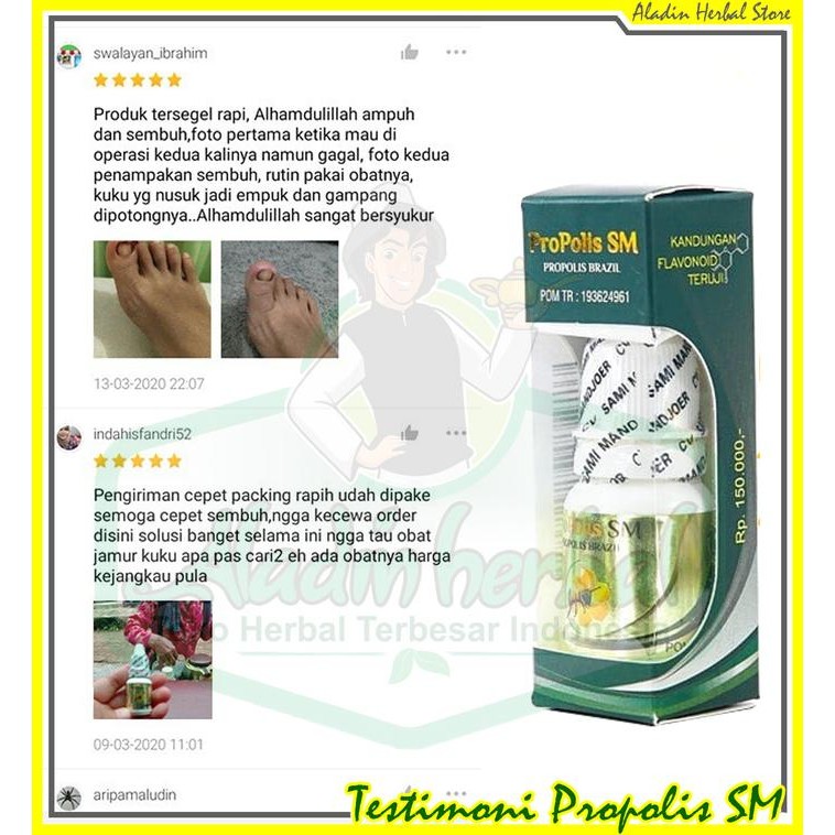 Obat Cantengan Jempol kaki - Obat infeksi jamur kuku - PROPOLIS SM ORI