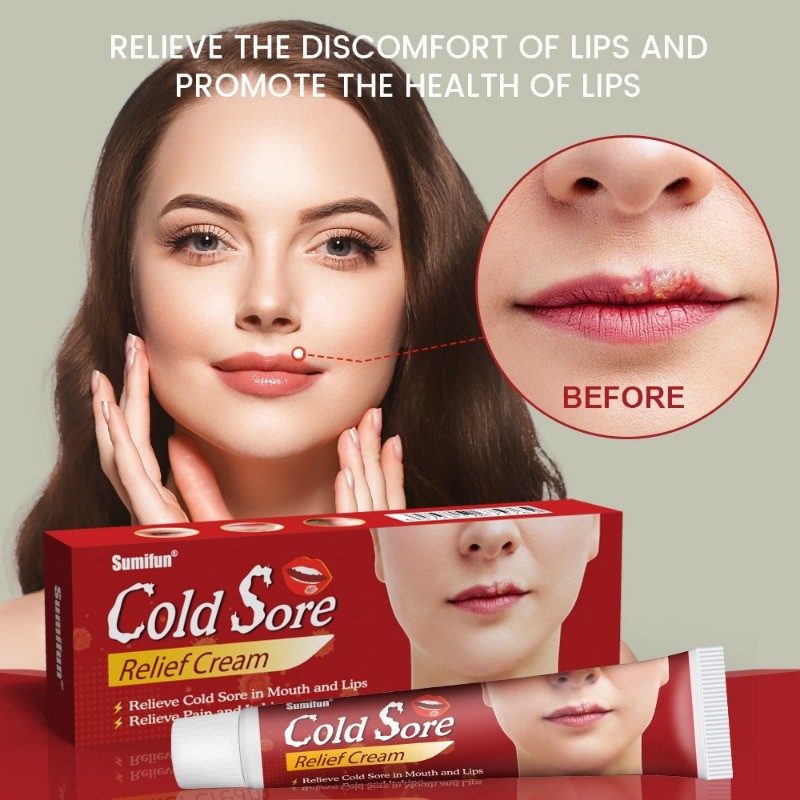Cold Sore Relief Cream Treat Lips Herp Cheilitis Ulceration Antipruritic Anti-inflammatory Antibacte