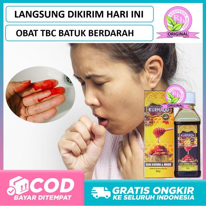 

TBC Batuk Berdarah & Berdahak - Herbal Bronkhitis, Sesak Napas, Nyeri Dada Shopee Terlaris