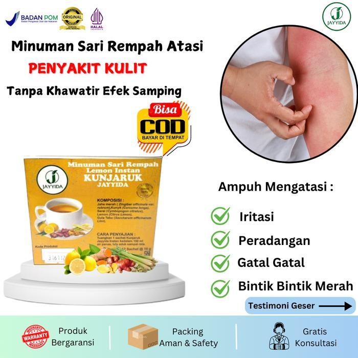 Obat Herbal Alami Untuk Atasi Penyakit Kulit - Gatal Gatal - Iritasi - Bintik Bintik Merah - Kudis