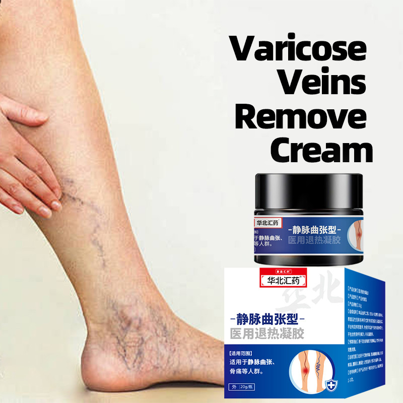 20g Varicose Veins Remover Cream Phlebitis Pain Relief Health Care Varicosity Angiitis Spider