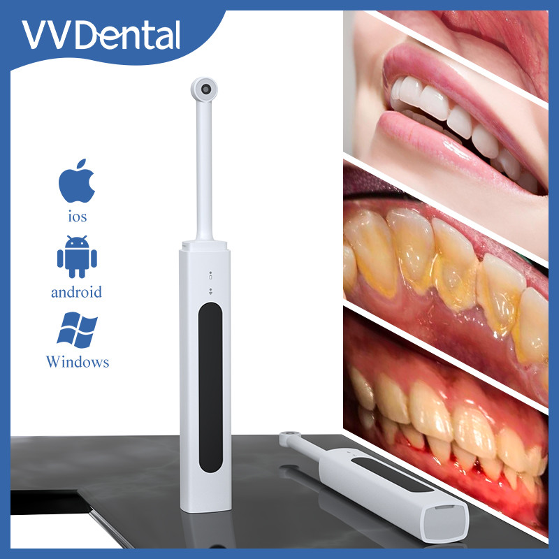 Dental Intraoral Camera Wireless WIFI Intra Oral Camera