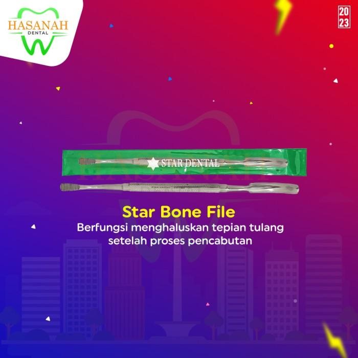 

Hot Sale! Star Bone File No.52