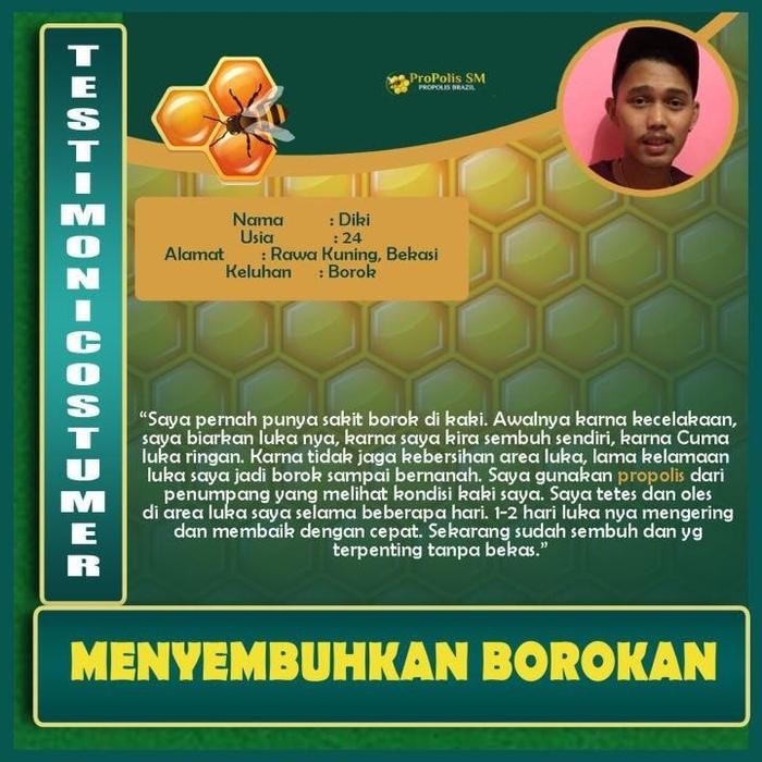 Propolis Sm Salep Cair Pengering Luka Basah Luka Bernanah Infeksi Kulit Gatal Kulit Bernanah Anak