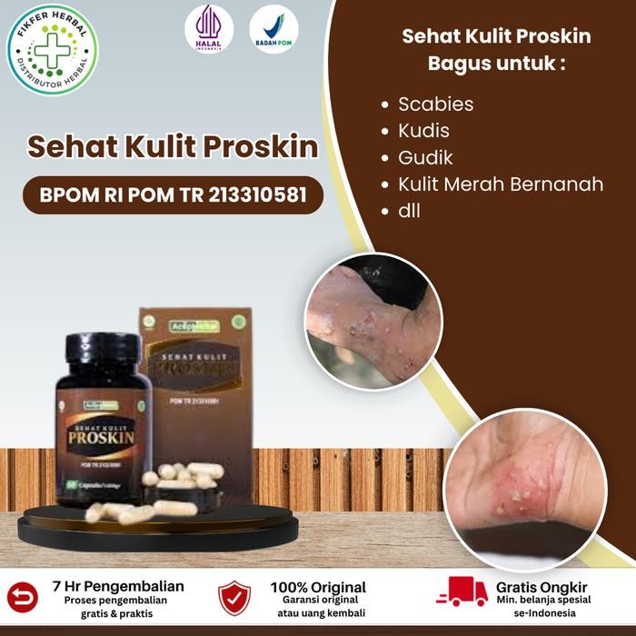Suplemen Scabies , Kudis, Scabies Merah Bernanah, Gudik - Sehat Kulit Proskin