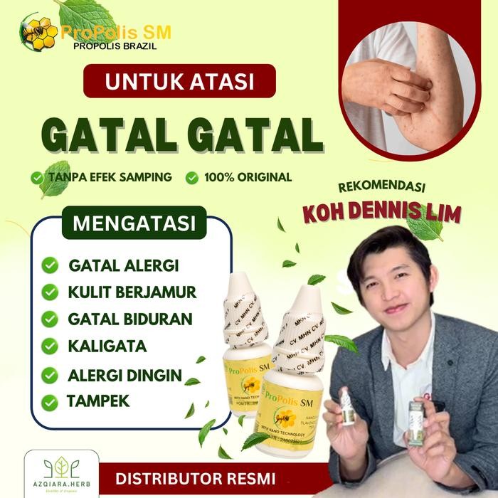 PROPOLIS SM Obat Gatal Gatal, Gatal Alergi, Jamur Kulit, Alergi Dingin, Gatal Biduran, Gatal Seluruh