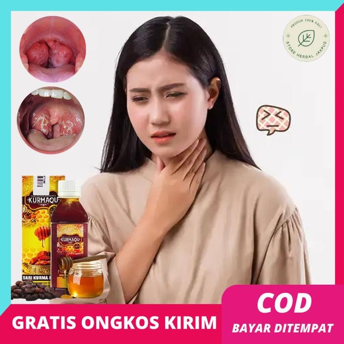 

Sale Madu Khusus Radang Amandel Menahun Sakit Tenggorokan Untuk Pengecil Amandel Bengkak Anak Dewasa
