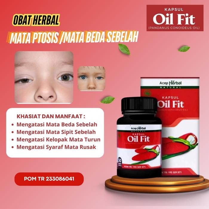 0bat Mata Ptosis, Mata Beda Sebelah, Mata Sipit Sebelah, Kelopak Mata Turun, Mata Kecil Sebelah,