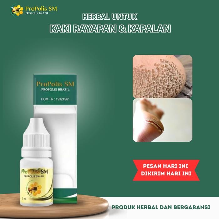 Oles untuk Kaki Rayapan Dan Bau Telapak Kaki Bolong-Bolong Kaki Pecah-Pecah Kaki Rinyuhan Kaki