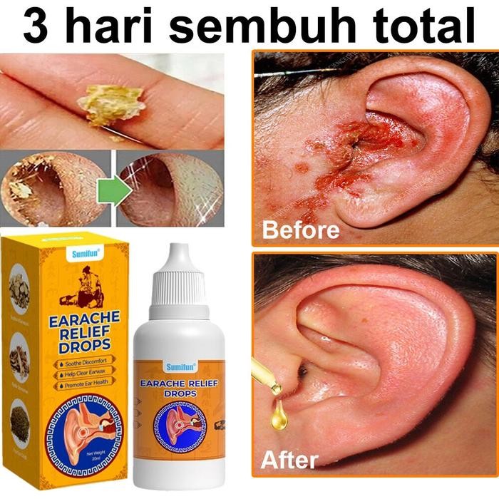 Obat Tetes Telinga Radang Telinga Infeksi Telinga Pendengaran Meredam Obat Telinga Bernanah Obat
