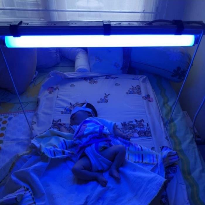 Philips TL UV Blue light 20Watt/Lampu UV baby kuning komplit set *