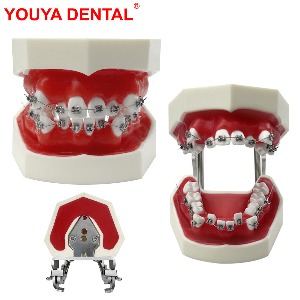 New Orthodontic Model Wax Gum Teeth Model Dental Practice Typodont With Metal Bracket For Ortho Tran
