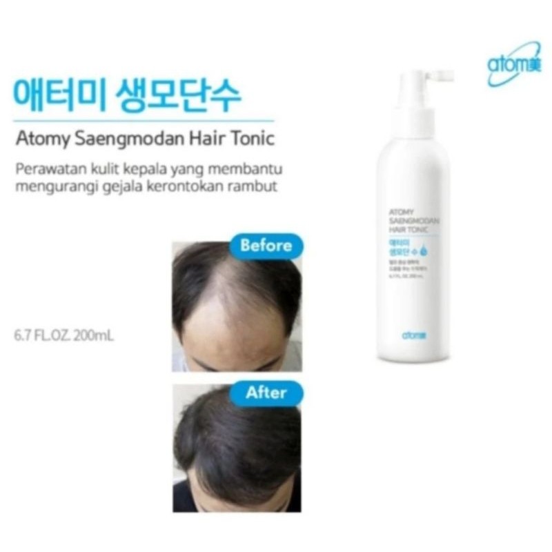 Hair tonic saengmodan Perangsang tumbuh Rambut cepat