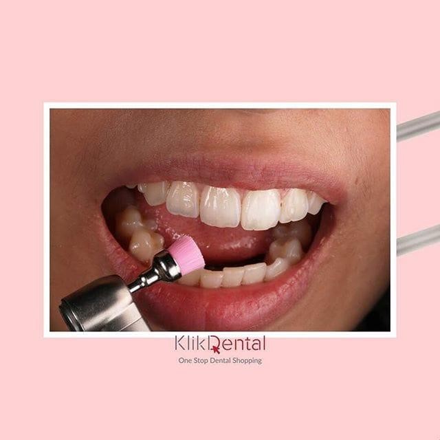 

AT KLIK DENTAL After Scalling Brush (25pcs)