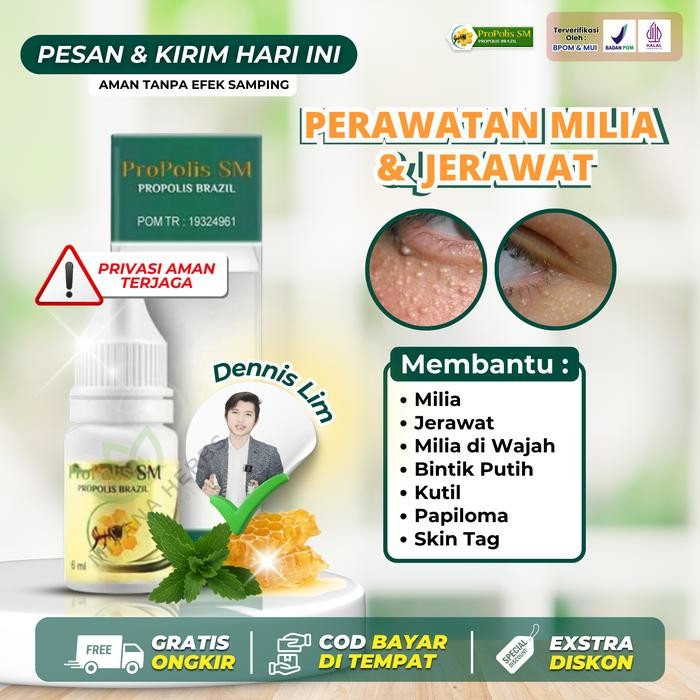 Propolis SM Penghilang Milia, Jerawat Milia, Milia di Wajah, Milia di Sekitar Mata, Bintik Putih di