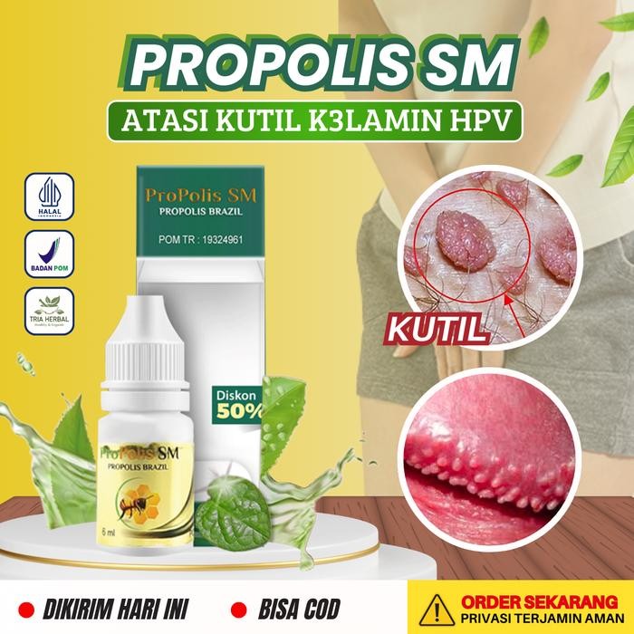 Cairan Kutil Kelamin HPV, Perontok Kutil Kelamin Jenger Ayam HPV, Menghilangkan Rasa Gatal pada