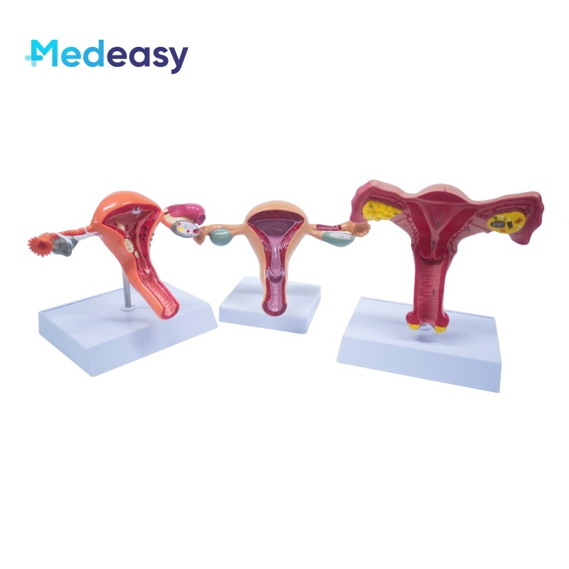EXCLUSIVE Female Uterus and Ovary Anatomical Model Vagina Model Plastic Uterus Model Normal/Diseased