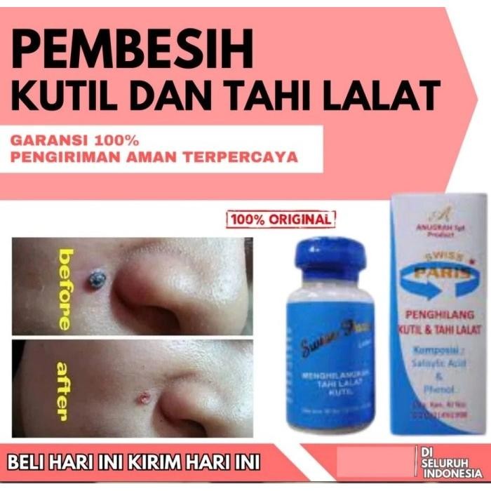 SWISS PARIS LOTION PENGHILANG TAHI LALAT KUTIL TANPA OPERASI HASIL PERMANEN KRIM TAI LALAT CREAM