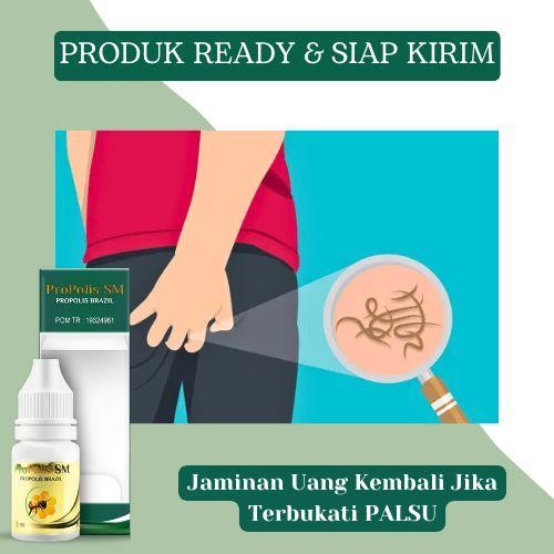 Solusi Infeksi cacing kremi Di Lubang Anus Dubur, Bengkak Di bagian Anus, Nyeri Dubur Wasir Luar