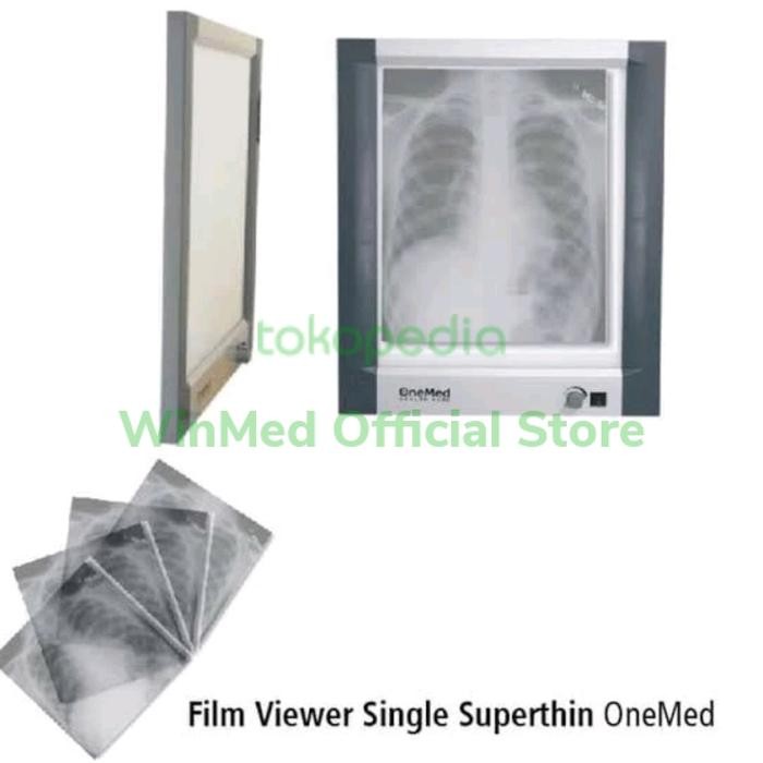X-Ray Viewer Single Lampu Baca Rontgen Ronsen Led Onemed Xray Single