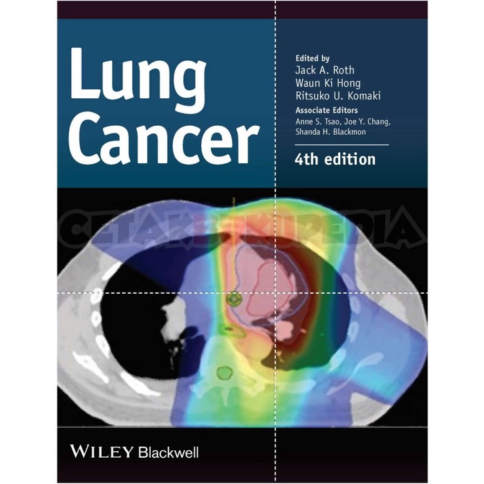 Book Lung Cancer Jack Rath Softcover