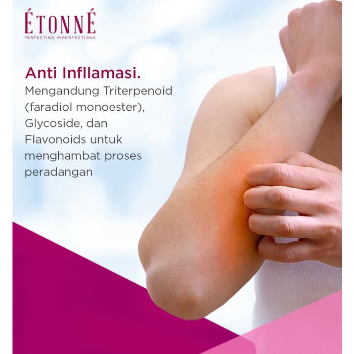 Ready Stock Etonne Calendula Skin Care Cream Krim Anti Nyamuk Luka Bakar Iritasi Kulit Antiseptik