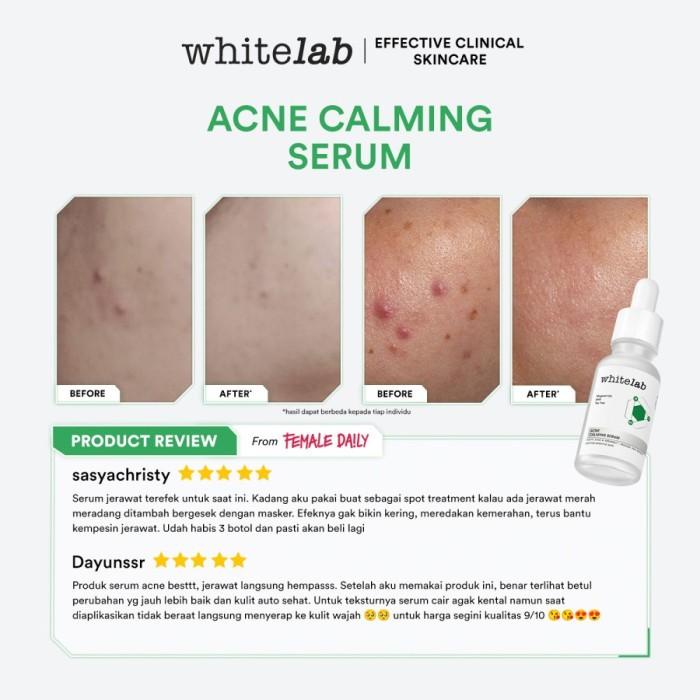 WHITELAB ACNE CALMING SERUM SKINCARE SERUM UNTUK KULIT JERAWAT DAN BRUNTUSAN BEST SELLER