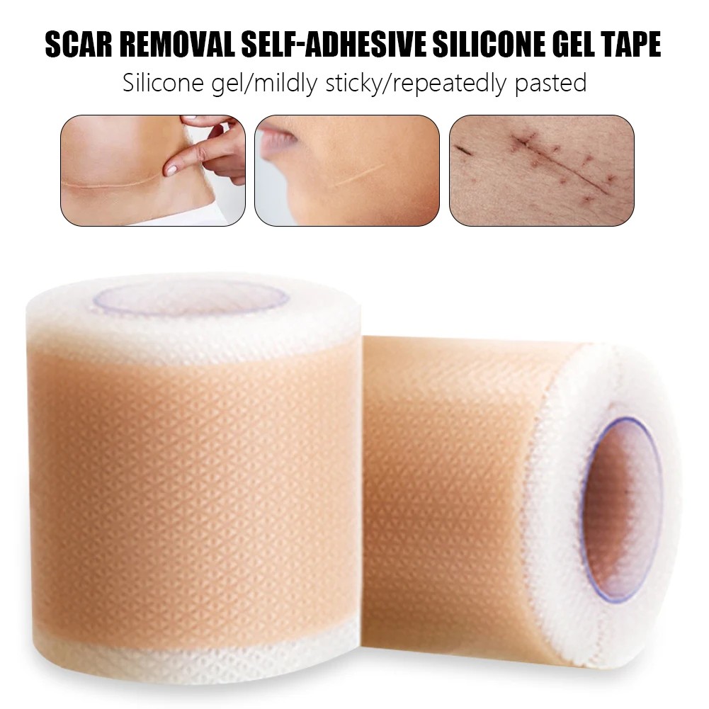 

50-150Cm Efficient Surgery Scar Removal Silicone Gel Tape Self Adhesive Therapy Patch For Acne