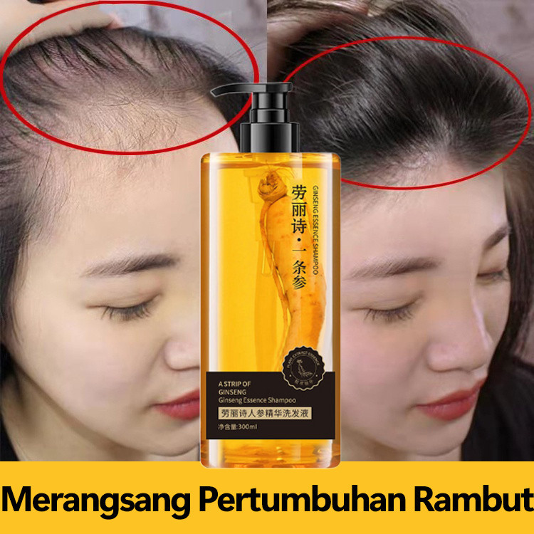 Shampo Ginseng Shampo Pertumbuhan Rambut Menyuburkan dan Meningkatkan Pertumbuhan Rambut Shampo Anti