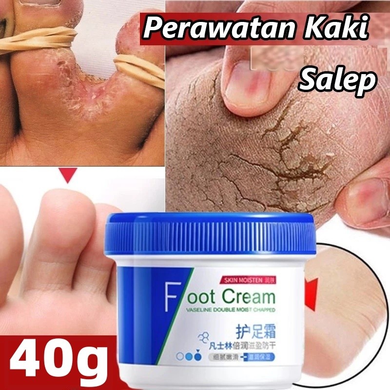 MD Vaseline kaki pecah dan kering Foot cream Obat kaki pecah Pelembab kaki kering dan pecah