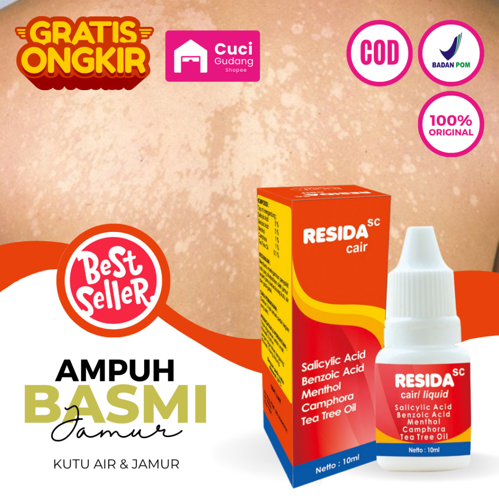Obat Panu Paling Ampuh 100% Obat Panu Cair Obat Kutil Kaki Dan Tangan Salep Obat Kurap Paling Ampuh