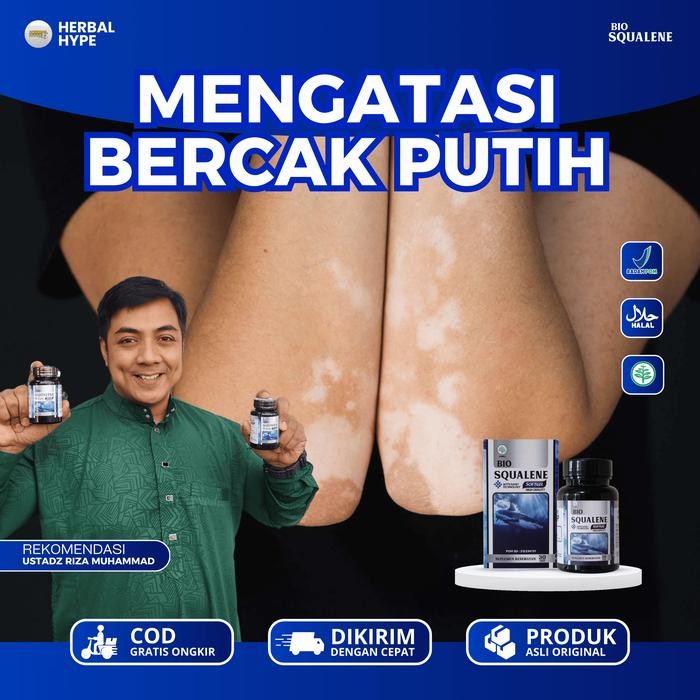 Bio Squalene Vitiligo, Penghilang Vitiligo, Bercak Putih Di Tangan, Wajah, Punggung, Penyakit Kulit