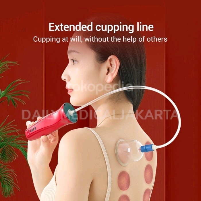 Terlaris Alat Terapi Bekam Kop Angin Elektrik Cas - Electric Cupping Device SALE