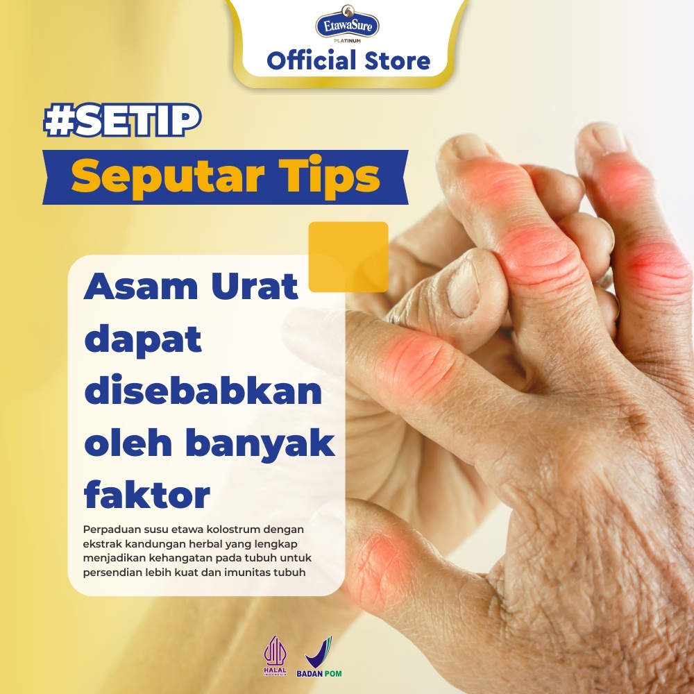 

Susu Kambing Etawa Platinum Untuk Asam Urat Nyeri Sendi dan Pegal Linu Etawasure Susu Etawa 2 Box