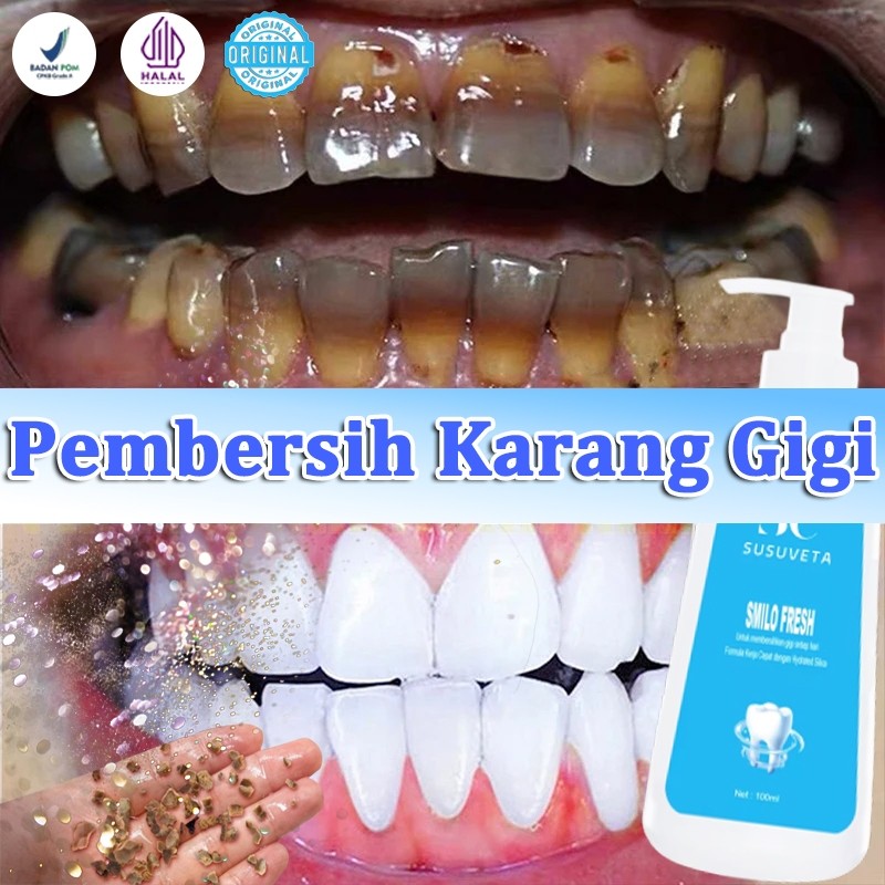 Odol Pemutih Gigi Dan Karang Gigi Perontok Karang Gigi Pembersih Gigi Kuning Dan Karang 100ml